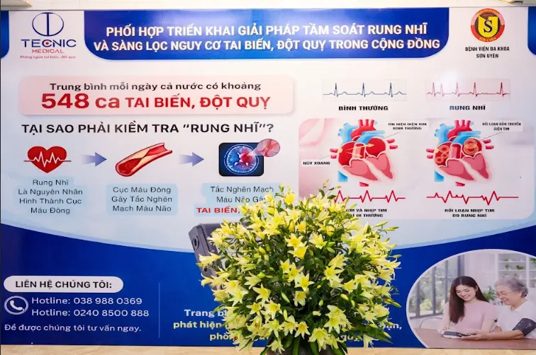 Đột quỵ ở người trẻ: Khi "sát thủ" không còn đợi tuổi, liệu bạn có đang trong tầm ngắm?